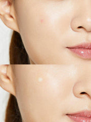 COSRX ACNE PIMPLE MASTER PATCH 24 PCS